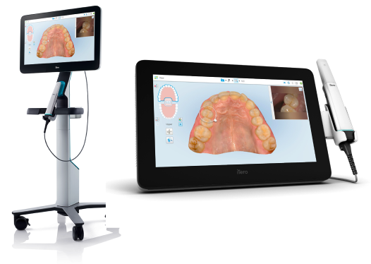 iTero Luminaとは？